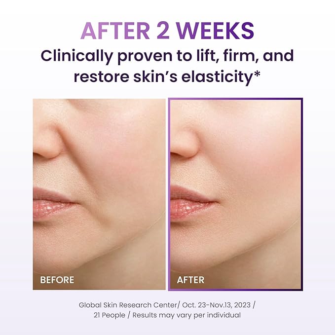 Probioderm 3D Lifting Cream 1.7 fl oz | Advanced Korean Anti-Aging Probiotic Facial Night Cream with 17-Peptide Complex & Patented Probioderm for Wrinkles on Face and Neck
