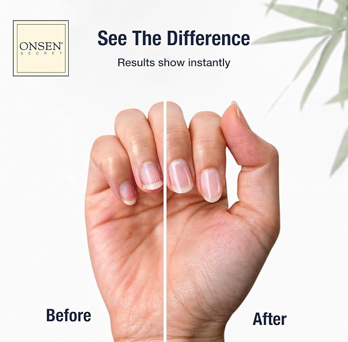 Onsen Nail & Cuticle Cream Treatment w/Japanese Tsubaki, Jojoba & Lavender Oil, Shea Butter – Strengthens Nails, Softens Cuticles - Daily Repair Care (1 Count/30 ml)