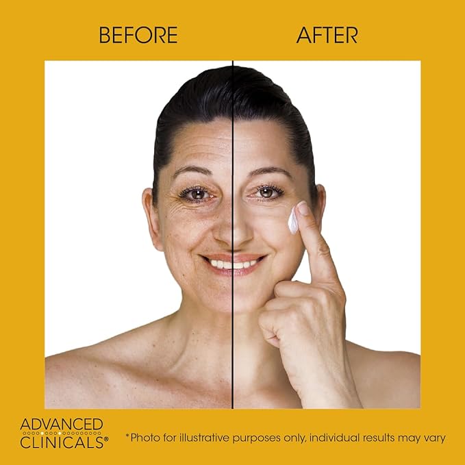 Advanced Clinicals Retinol Body Lotion + Sagging