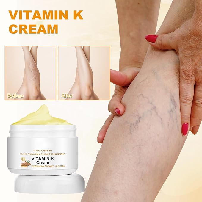2PCS Varicose Veins Miracle Cream, Vitamin