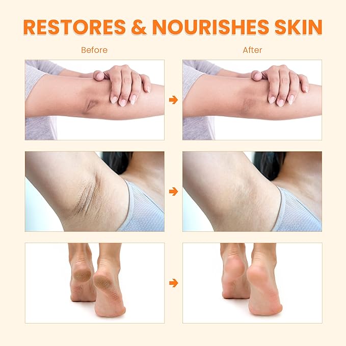 Dark Spot Cream, Brightening Cream, Underarm