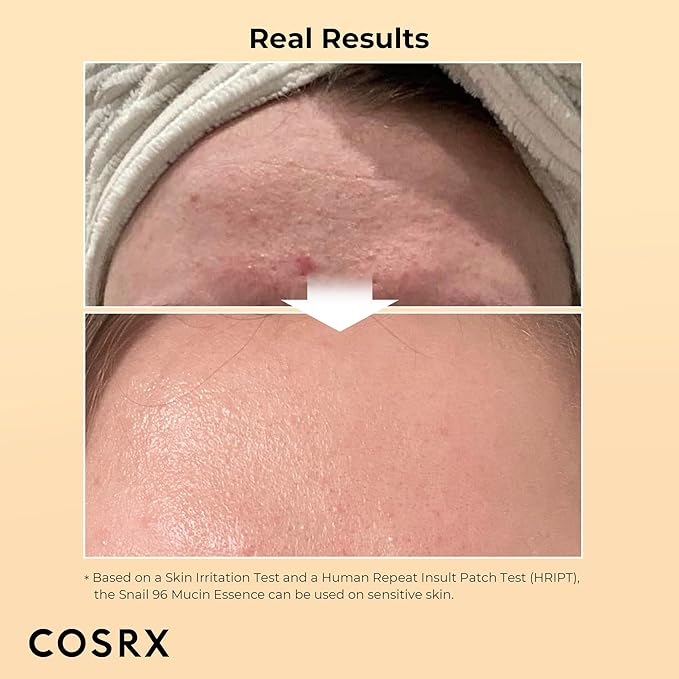 COSRX Snail Mucin 96% Power Repairing Essence 3.38 fl.oz, Hydrating Serum for Face with Snail Secretion Filtrate, Mothers day gifts for mom, Korean Skin Care