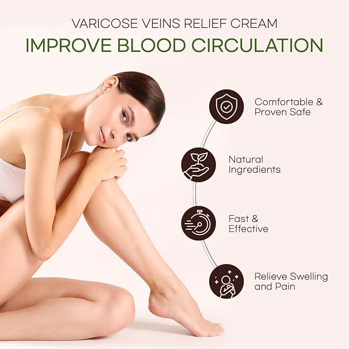 Varicose Veins Cream - Varicose Veins