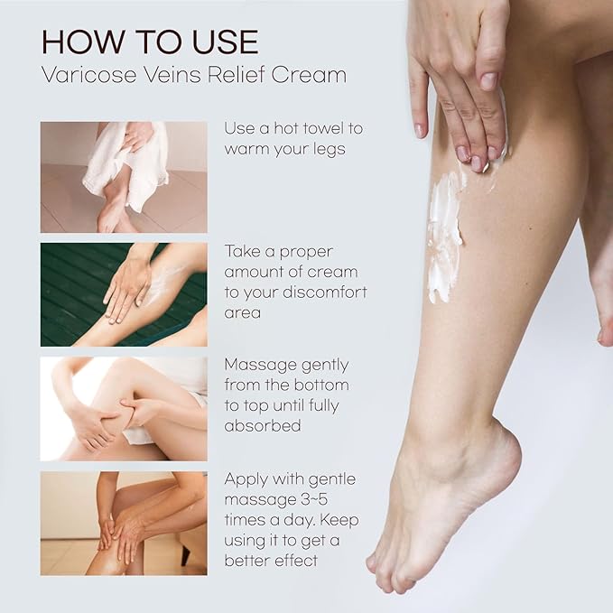 Varicose Veins Cream - Varicose Veins