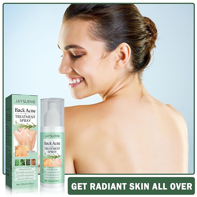 Back Acne Treatment Spray, Body Acne