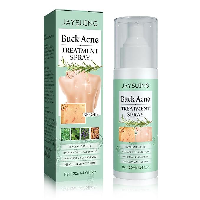 Back Acne Treatment Spray, Body Acne