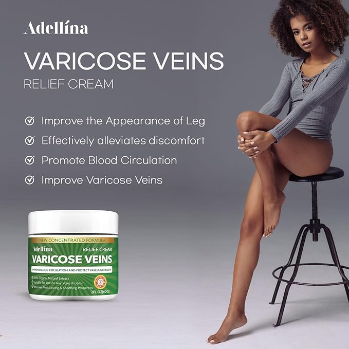 Varicose Veins Cream - Varicose Veins