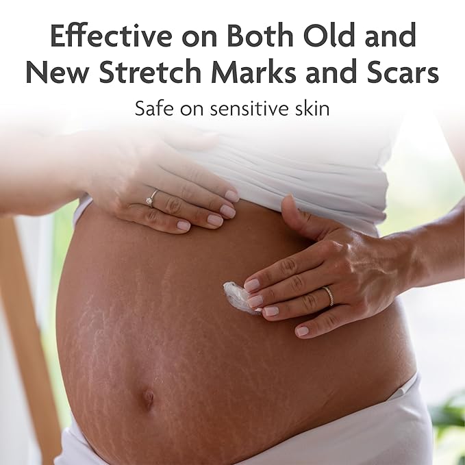 TriLASTIN-SR Intensive Stretch Mark Cream (5.5 Moisturizing