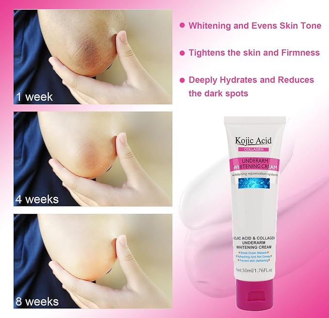 Kojic Acid Skin Whitening Cream