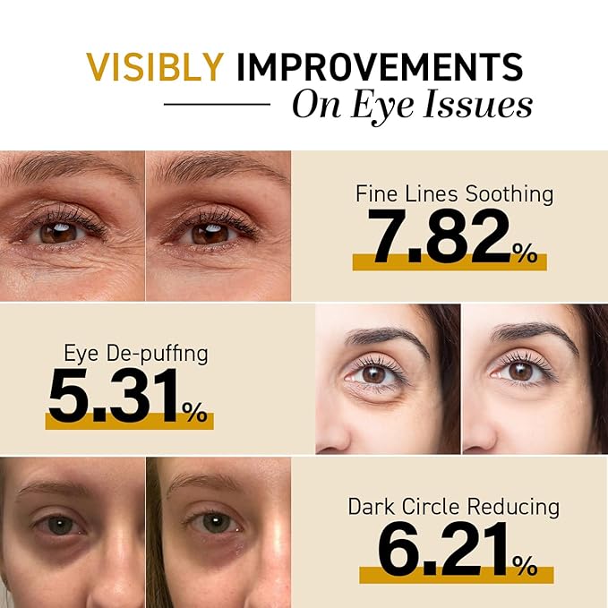 CITYGOO Eye Cream For Dark Circles: Eye Puffiness Under Eye Bags Treatment - Anti-Wrinkle (Snail Eye Stick 1 Count)