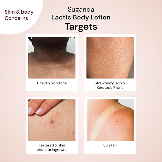 Unscented Lactic Body Lotion With 5% Lactic Acid,Improves Skin Texture & Reduce Strawberry Legs 6.76 Fl Oz