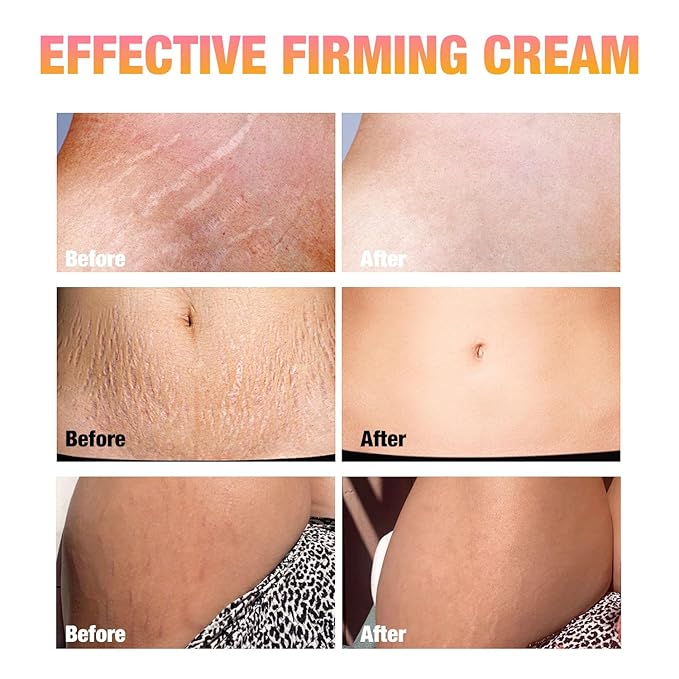B Flat Belly Firming Cream -