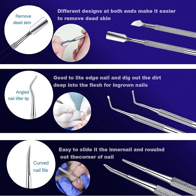 Ingrown Toenail File and Lifters