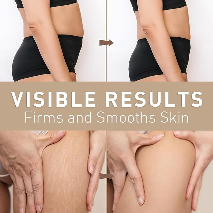 Belly Firming Cream for Tightening and