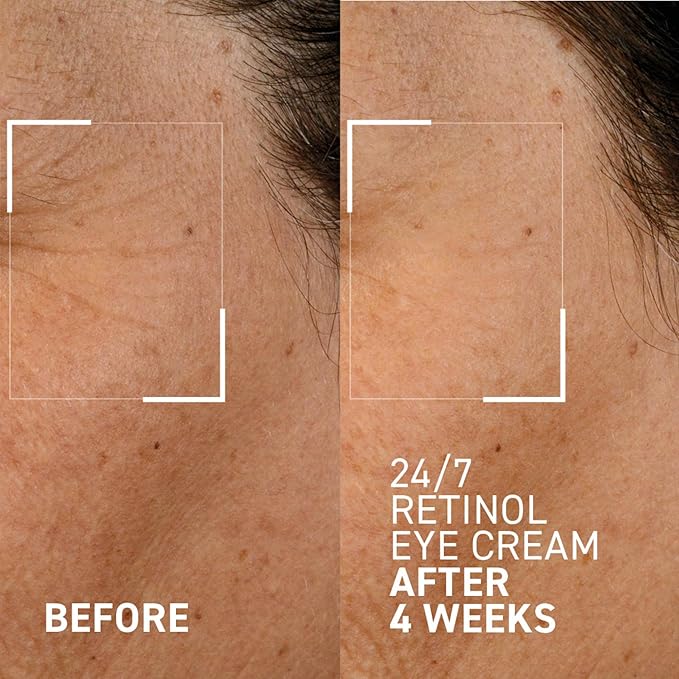 Dr. Brandt Bright This Way 24/7 Retinol Eye Cream - 0.5 oz, Pack of 2 - Smooths the Look of Fine Lines & Wrinkles, Illuminates & Moisturizes the Eye Area