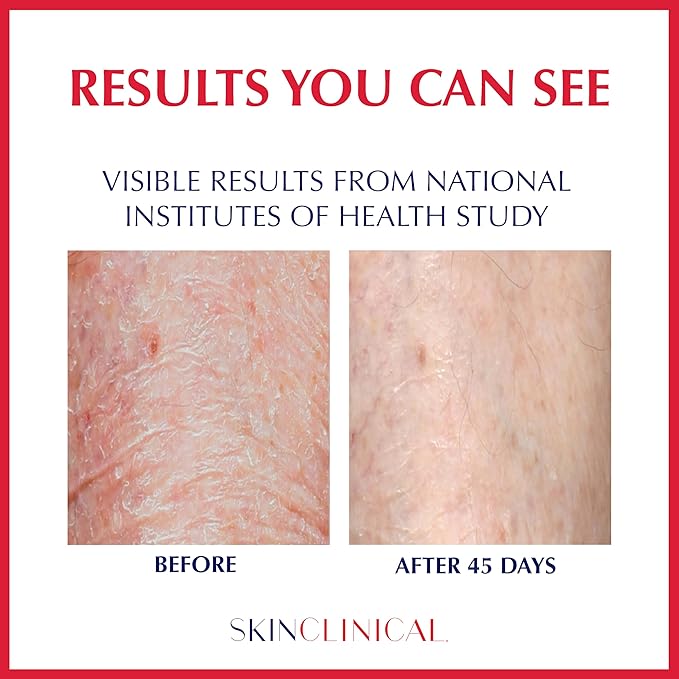 Extreme Healing, Non-Sticky, Fast-Absorbing Lotion For