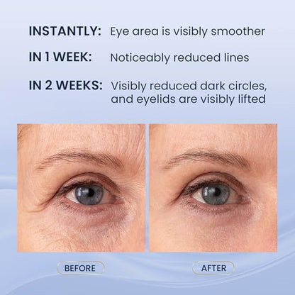 Dual Eye Cream with Advanced Retinol, Peptides, Caffeine for Puffy Eyes and Dark Circles, Wrinkles, Anti Aging, Under Eye Bags Treatment, Instant Tightener, Fragrance Free, 0.68 OZ