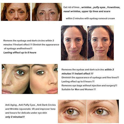 Magic Eye Cream, Instantly Remove Under Eye Bags Wrinkles Puffiness Dark Circles and Fine Lines, Anti Aging Eye Cream for Men Women