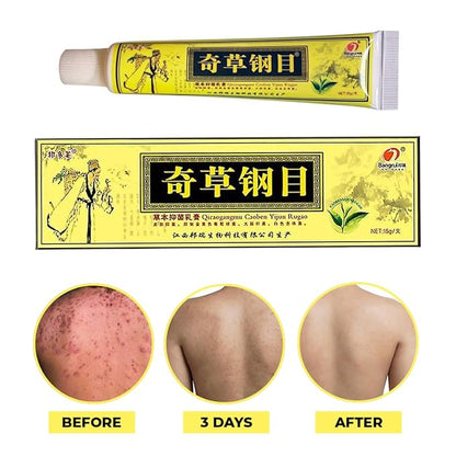 Official Seller - Chinese Herbal Cream
