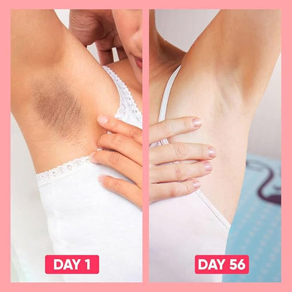 Skin Bleaching Cream for Body Intimate