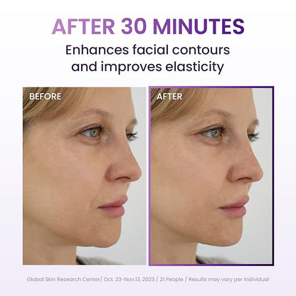 Probioderm™ 3D Lifting Full Face Tension Gel Mask | NOT a Hydrating Mask – Firming & Tightening for Lifted, Sculpted Skin | 20-Peptide Complex & PDRN for Face Contouring & Jawline Definition
