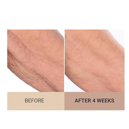 Consult Beaute - Champagne Beaute Lift