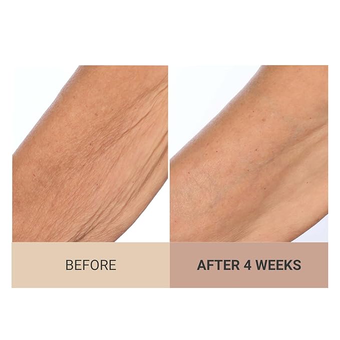 Consult Beaute - Champagne Beaute Lift