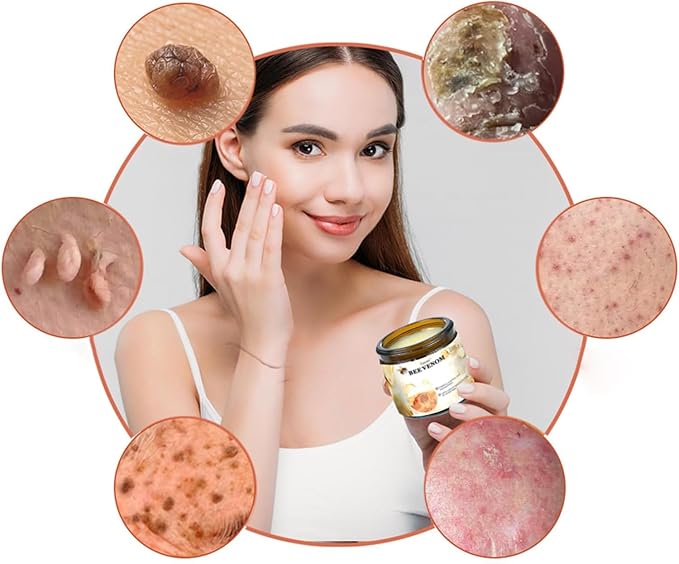 Bee Venom Cream,New Bee Venom Repair