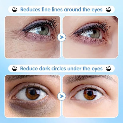 Under Eye Patches for Dark Circles, Puffy Eyes & Wrinkles - 60 Pairs Hydrating Eye Mask with Hyaluronic Acid, Blueberry Extract - Vegan, Cruelty-Free