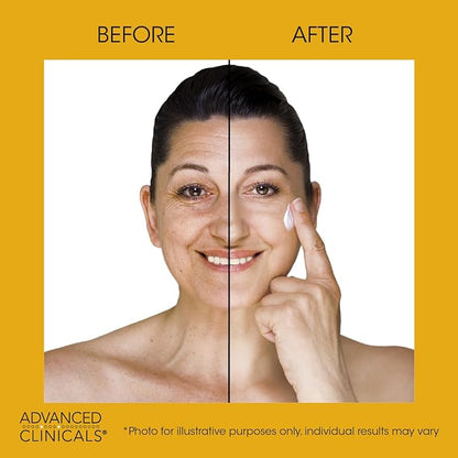 Advanced Clinicals Retinol Body Lotion + Sagging