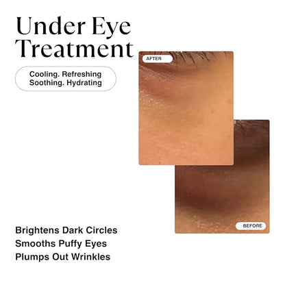 MATKAS Korean Vitamin C & Caffeine Eye Cream for Dark Circles and Puffiness 0.5 Fl Oz - Dark Circles Under Eye Treatment, Under Eyes Cream Anti Aging with Shea Butter Vitamin E for Puffy Eyes Wrinkles