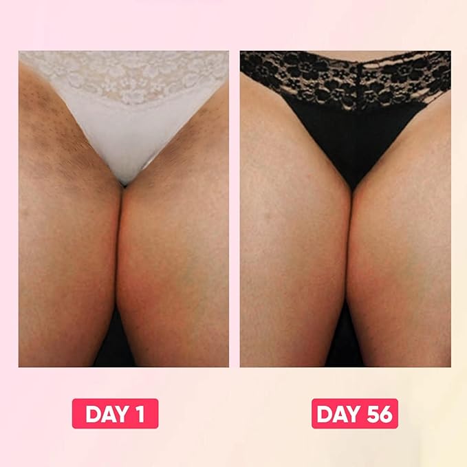 Skin Bleaching Cream for Body Intimate