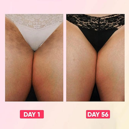 Skin Bleaching Cream for Body Intimate