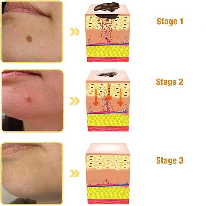 Bee Venom Professional Gel, 2024 New