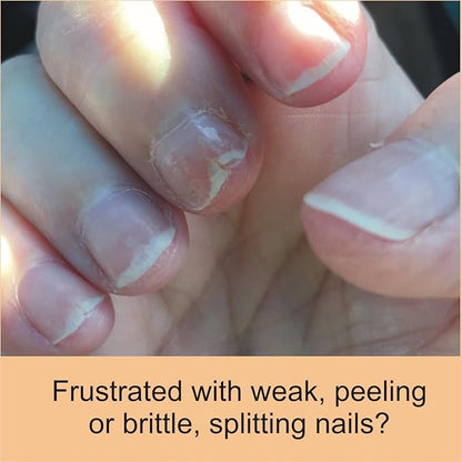 Penetrating Fingernail Conditioner and Strengthener to repair and then maintain weak and peeling or brittle and splitting nails - Single Bottle