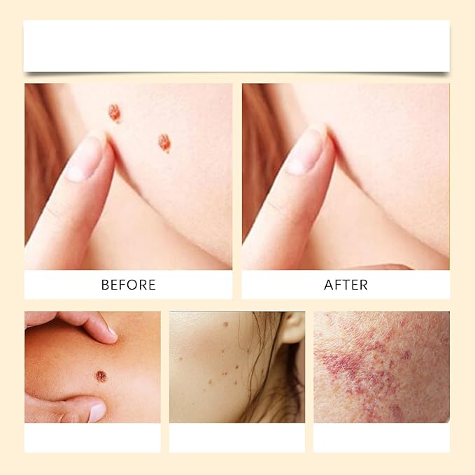 Bee Venom Repair Cream, 3 PCS