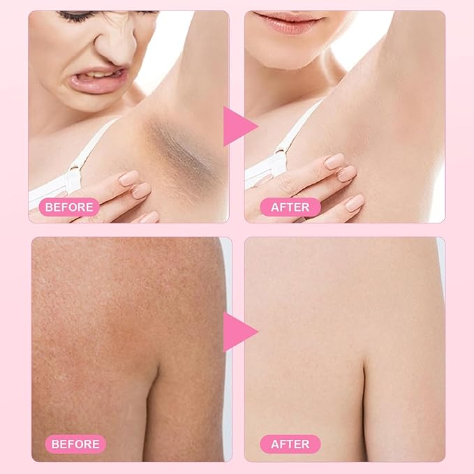 2PCS Brightening Underarm Cream,Pearl Capsules Cream，Brightening