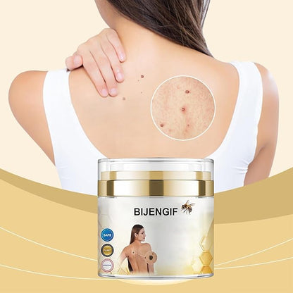 Bee Venom Cream for Removing and