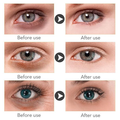 Magic Retinol Eye Cream for Dark Circles Puffiness and Bags Under Eyes, Instant Results Firm Eye Tightener Reduce Fine Lines Wrinkles Anti Aging Eye Cream for Men Women Suitable for Sensitive Skin