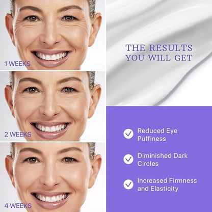 ESSENLIS Caffeine Eye Cream for Dark Circles and Puffiness, Bags Under Eyes, Collagen Anti Aging Day and Night Corrector for Women and Men