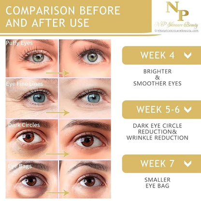 Anti-Wrinkles Eye Cream - Fast Absorbing, Natural Ingredients for Dark Circles, Puffy Eyes, and Wrinkle Reduction, 30 grams