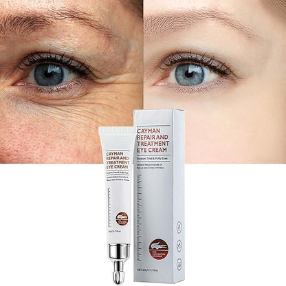 Magic Eye Cream, Instantly Remove Under Eye Bags Wrinkles Puffiness Dark Circles and Fine Lines, Anti Aging Eye Cream for Men Women