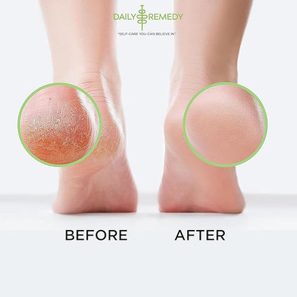 Tea Tree Oil Foot Soak with Epsom Salt - Made in USA - for Toenails, Athlete's Foot, itchy Feet, Stubborn Smelly Foot Odor, Pedicure, Foot Calluses & Soothes Sore Tired Achy Feet - 64 oz