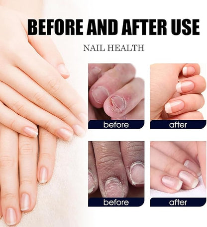 2PCS Ginger Nail Treatments, 7 Days Ginger Cuticle Care Oil for Nails,Nail Repair Cuticles Oil,Ginger Nail Oil for Strengthen nails & Promote Nail Growth, Natural Plant Formula