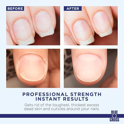 Blue Cross Cuticle Remover Cream for Dry Damaged Cuticles, Moisturizing Cuticle Softener for Nails, Professional Nail Care for Dry Manicures, Brittle Hang Nails, Made in USA, 4oz