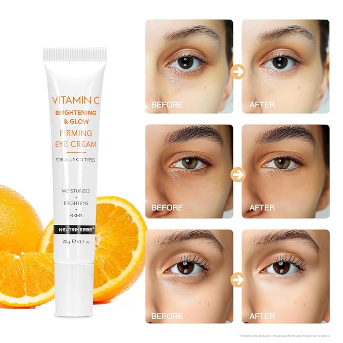 Neutriherbs Eye Cream Vitamin C Eye Gel for Dark Circles, Eye Bags, Puffiness, Eye Massage Under Eye with Hyaluronic Acid, 20g e/0.7 oz.