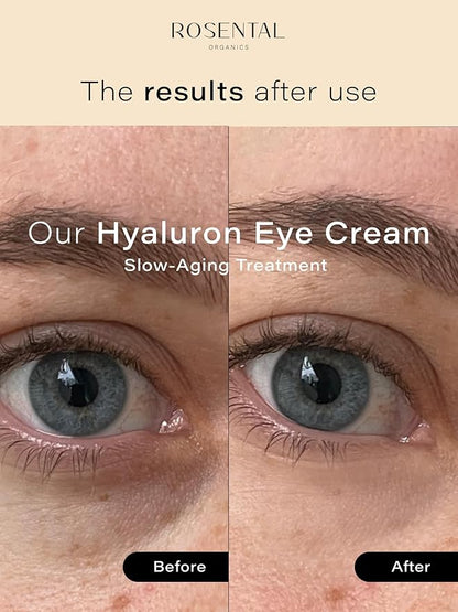 Organics Organic Eye Cream for All Skin Types, 15ml (0.5 fl. oz) (Hyaluron Eye Cream, 15ml)