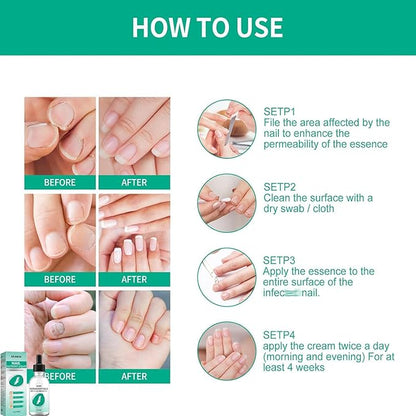 Kerassentials Toenail Oil, Kerassentials Nails Nutrient Oil, Nail Repair Solution 30ML/1PCS (4PCS)