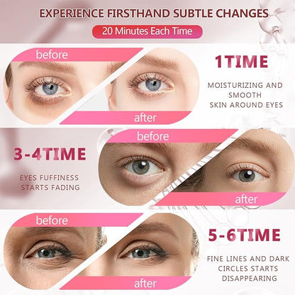 2 Packs 60 Pcs Under Eye Patches, 24K Gold+Pink, 30 Pairs Women Undereye Mask for Puffy Eyes Dark Circles Treatment, Men Collagen Gel Pads Hydrating for Eye Bags Puffiness Wrinkle, Beauty Skin Care