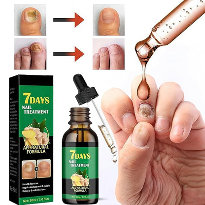 Ginger Nail Strengthener for Damaged Nails, 1Pc Treatment Oil, Ginger Nail Serum for Cracked Nails, Hand & Foot Strengthener, Fingernail Repair for Split Toenail, 30ML